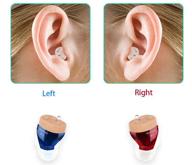 Rechargeable Invisible Hearing Aid